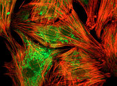 Celule inima