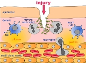 Inflamatia