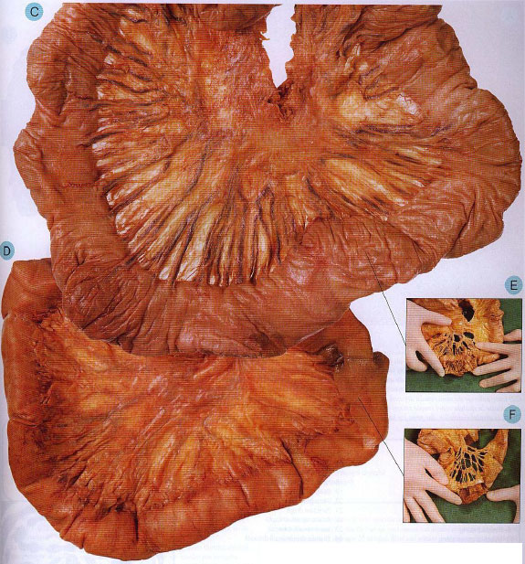 Intestinul subţire Intestinul subţire