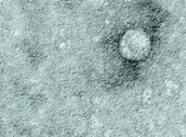 Hepatita C