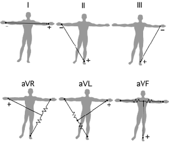 Triunghiul lui Einthoven
