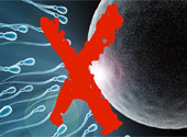 Contracepţie sonoră