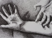 Artitră
