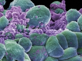 Celule canceroase
