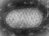 Poxvirus