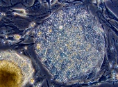 Celulele stem