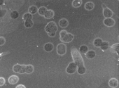 Porii unei membrane de grafen