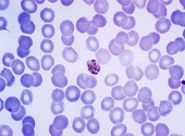 Plasmodium malariae