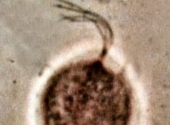 Trichomonas vaginalis