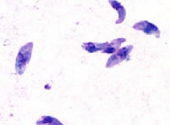 Toxoplasma gondii