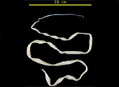 Taenia solium