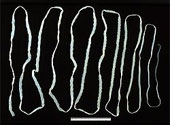 Taenia saginata