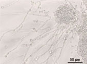 Candida_albicans