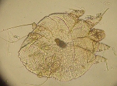 Sarcoptes scabiae