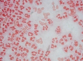 Neisseria gonorrhoeae
