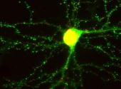 Neuron
