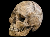 Craniu