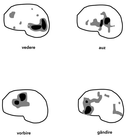 Scanare PET Scanare PET