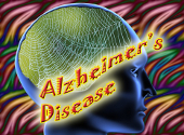Alzheimer