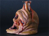 Alcoolism