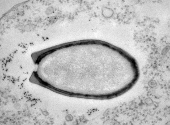 Pandoravirus