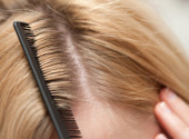 Scalp fara matreata