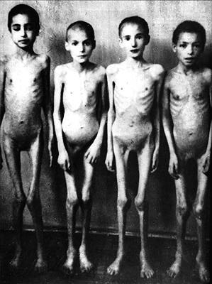 Copii, victime ale lui Mengele Copii, victime ale lui Mengele
