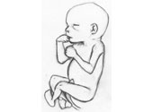 Fetus
