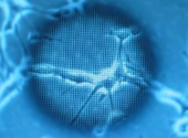 Celule stem