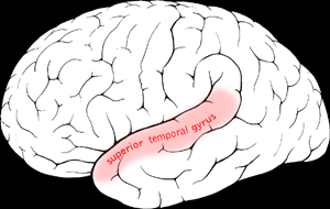 Girusul temporal superior Girusul temporal superior