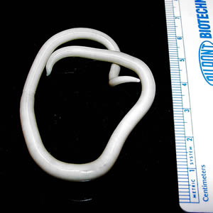 Ascaris lumbricoides Ascaris lumbricoides