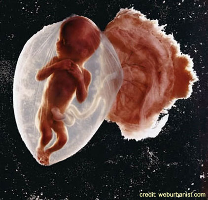 Fetus in sacul amniotic Fetus in sacul amniotic