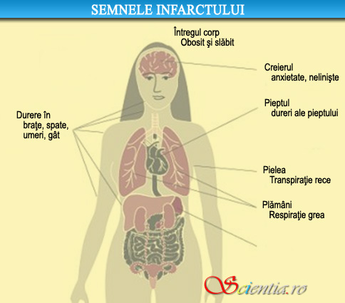 semnele infactului