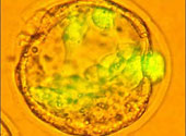 Celule stem