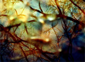 Neuroni