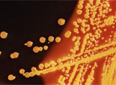 E.coli