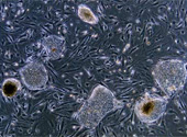 Celule stem