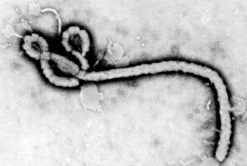 Virusul Ebola Virusul Ebola